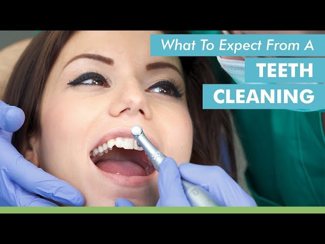 What To Expect From A Teeth Cleaning