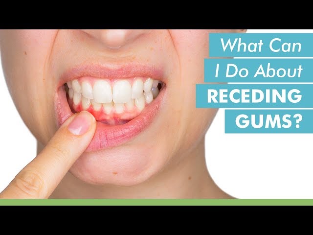 What Can I Do About Receding Gums?