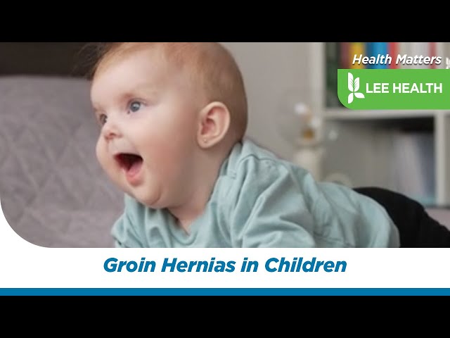 Groin Hernias in Children