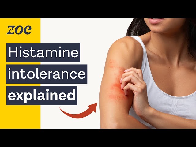 The surprising truth about histamine intolerance | Dr. Will Bulsiewicz