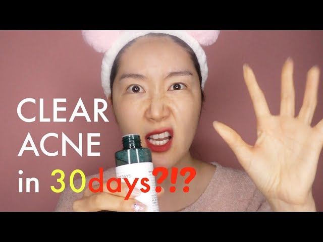 SOME BY MI AHA BHA PHA 30 Days Miracle Toner Review | 5 Min Review with Euni