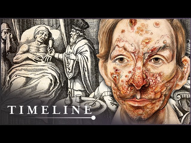 The True Terrors Of Tudor Medicine | Hidden Killers | Timeline