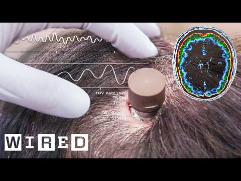 The Science Behind Elon Musk’s Neuralink Brain Chip | WIRED
