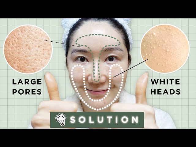 Remove Whiteheads & Unclog Tighten Large Pores w Patent Ingredients(Proven by clinical tests)