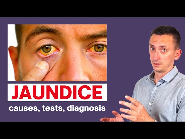 A Clinical Approach to Jaundice