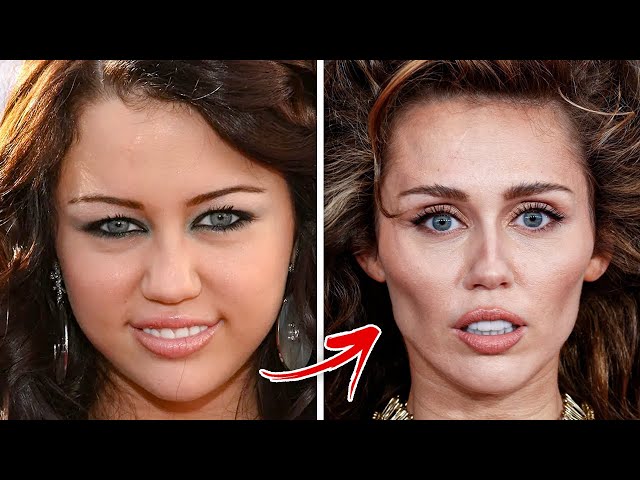 Celebrities Who Regret Their BOTCHED Plastic Surgeries