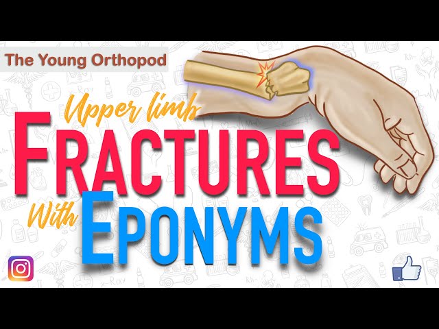 Named Fractures: UPPER LIMB, Fractures with EPONYMS, NEET PG, The Young Orthopod