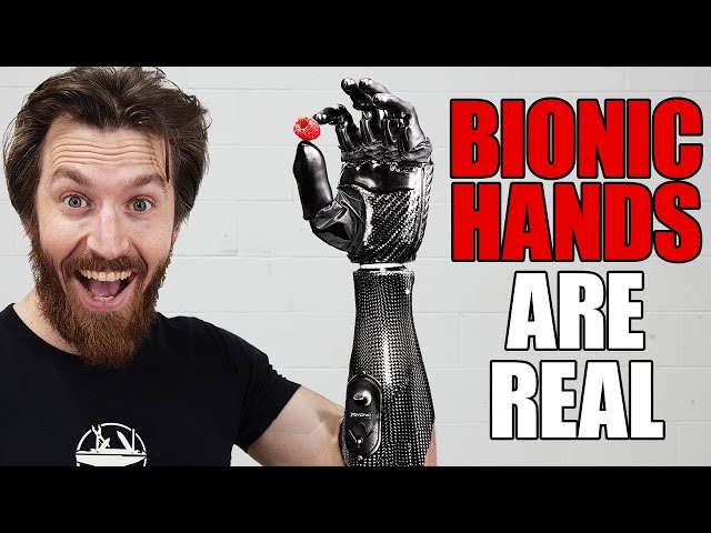 This Bionic Hand Will Change Everything!