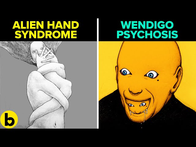 16 Rare Psychological Disorders Most People Don't Know About