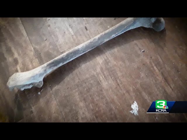 KCRA 3 Investigates Preview: Found femur sparks a three-year search for answers