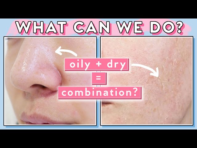 When Your Pores are Oily & Skin is Dry at the Same Time?! Combination Skin Tips!