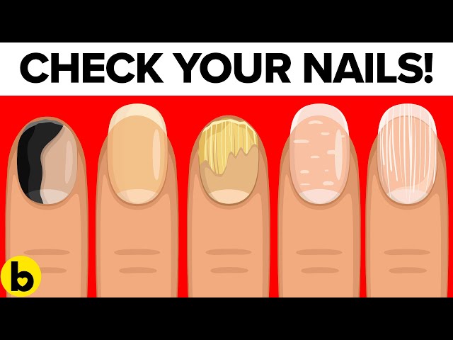 8 ALARMING Things Your Nails Is Warning You About Your HEALTH! ⚠️💅