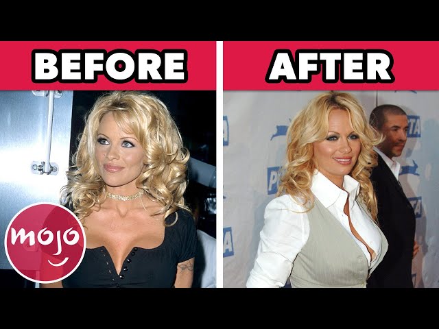 Top 20 Celebrities Who Regret Their Plastic Surgery