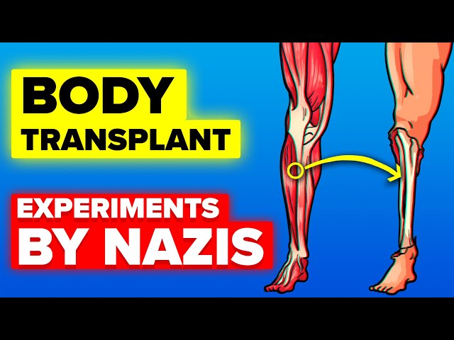 Body Transplantation - Nazi Camp Experiments