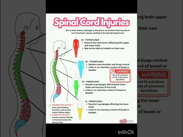 Spinal cord injuries by Shweta