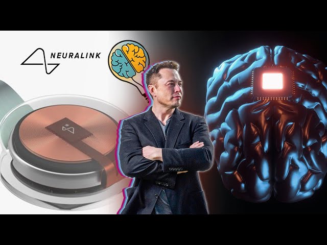 Elon Musk's Neuralink Gets a Shocking Go-Ahead: Human Trials in 2023!