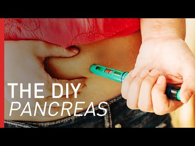 Treating Diabetes with a DIY Pancreas | Freethink DIY Science