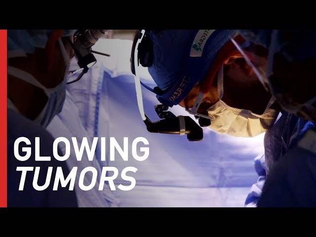 Making Tumors Glow to Improve Cancer Surgery