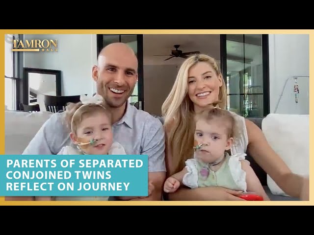 Parents of Separated Conjoined Twins Reflect on Their Miraculous Journey