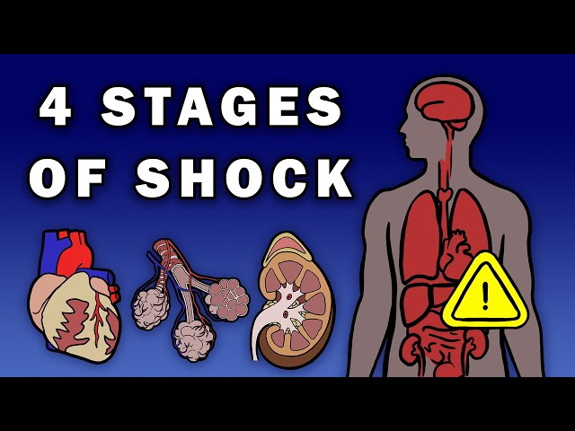 THE 4 STAGES OF SHOCK