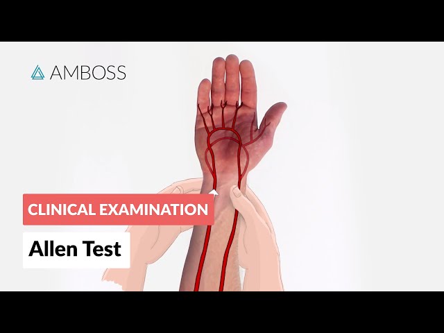 Modified Allen Test - Clinical Examination