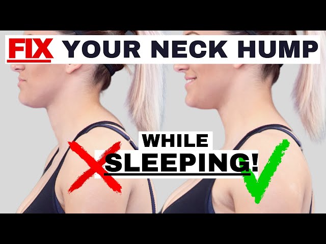 BEST sleeping position to FIX Neck Hump, Hunchback, or Forward Head Posture | Dr. Jon Saunders