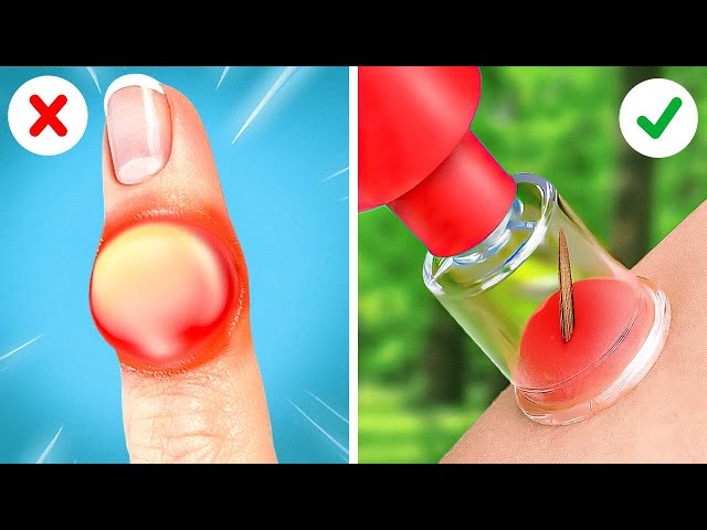 EMERGENCY AND SURVIVAL HACKS || CRAZY PARENTING HACKS AND TRICKS BY 123GO Like!