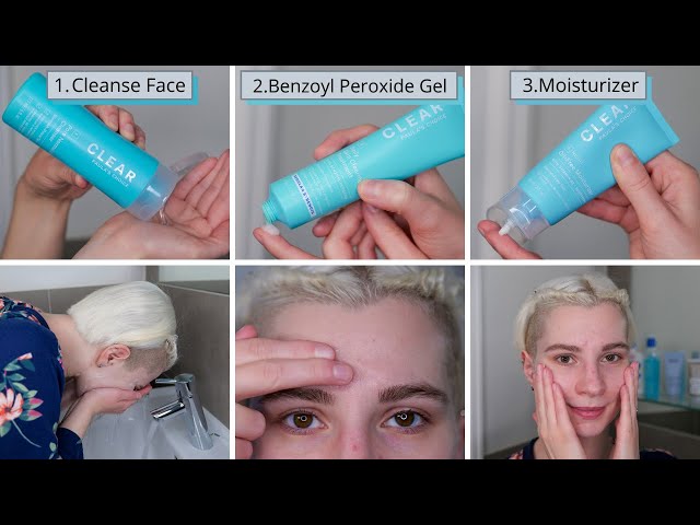 How to use Paula’s Choice Daily Skin Clearing Benzoyl Peroxide Treatment