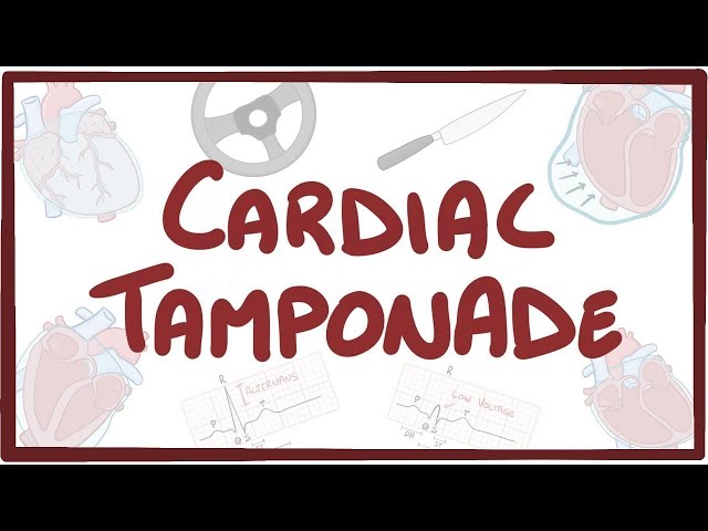 Cardiac tamponade - causes, symptoms, diagnosis, treatment, pathology