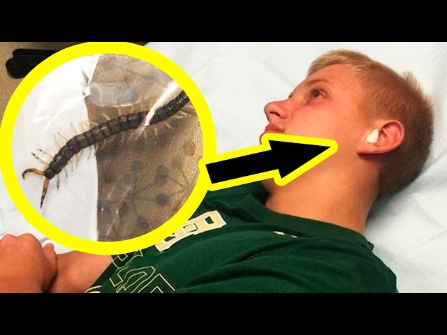 10 Animals Found Living In Human Ears