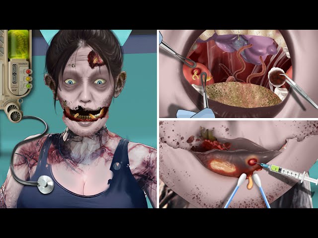 ASMR Treatment for zombie girl with rotten teeth, dental rehabilitation, white tongue