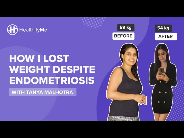 How I Lost Weight Despite Endometriosis - With Tanya Malhotra | Weight Loss Story | HealthifyMe