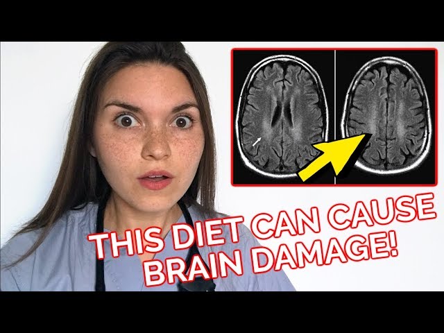 21 year old ate THIS DIET and it caused BRAIN DAMAGE: Medical Case Report