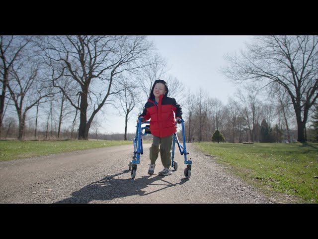 Selective dorsal rhizotomy brings improved mobility for boy with spastic cerebral palsy