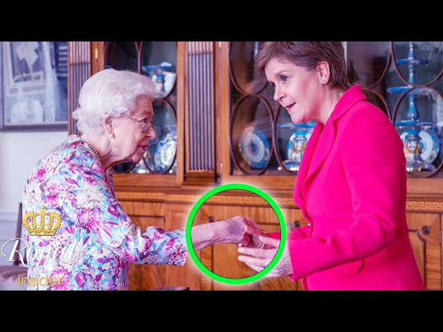 Queen health fears erupt as monarch's hand appears bruised during meeting with Nicola Sturgeon