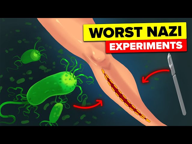 Bacteria Inside Wounds - Nazi Camp Experiments