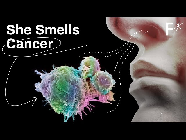 Woman's smelling "superpower" detects cancer and Parkinson's | Just Might Work by Freethink