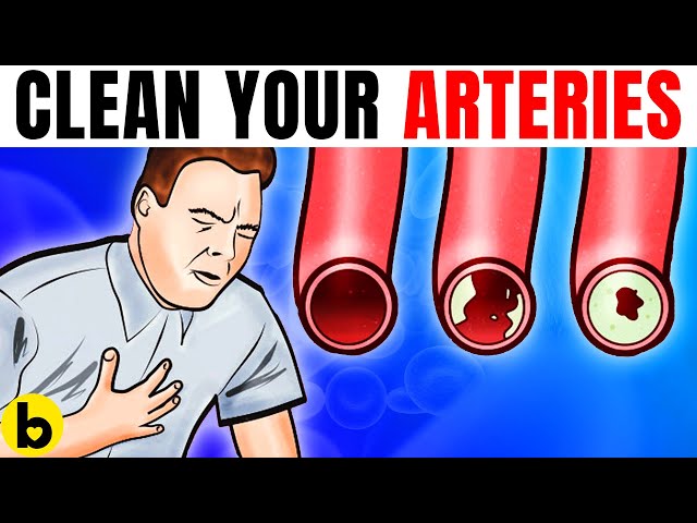 These Foods Unclog Arteries & Can Prevent A Heart Attack