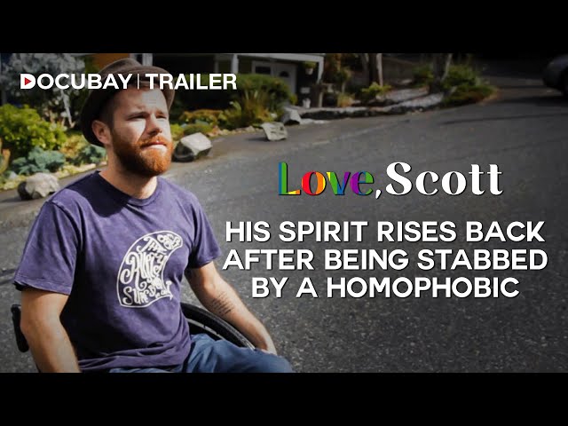 Love, Scott Official Trailer: The Comeback of a Hate Attack Survivor