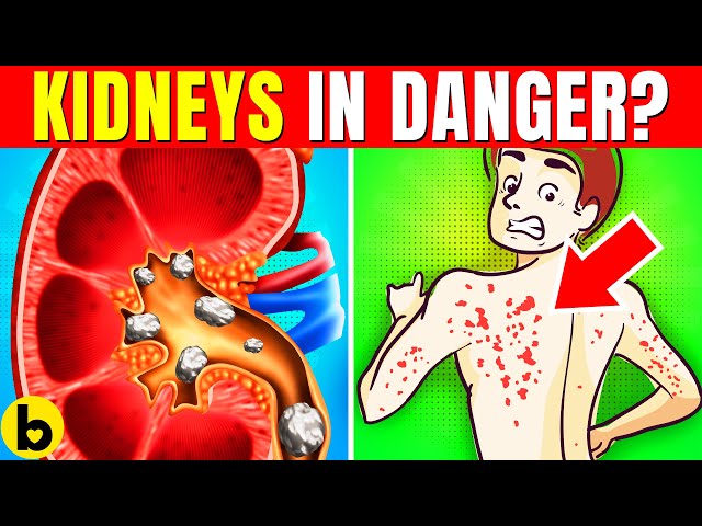 12 ALARMING Signs Your Kidneys May Be In DANGER! ⚠️