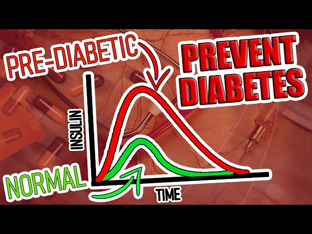How Hidden Prediabetic Patients are found with Kraft Tests and 5 Major Causes of Insulin Resistance