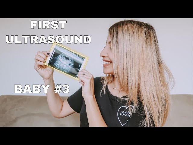 SEEING OUR BABY FOR THE FIRST TIME!!
