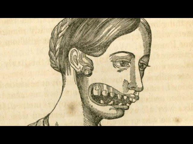 The Messed Up Truth About The Radium Girls