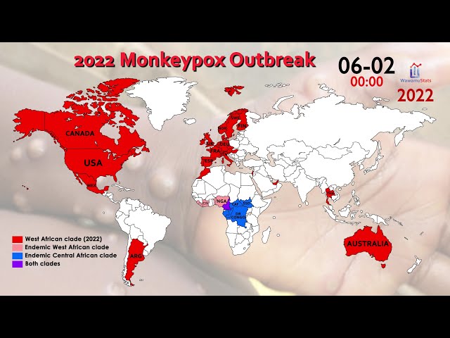 The Spread of Monkeypox in 2022 (Map Timelapse)
