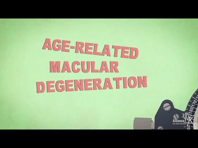 Age-Related Macular Degeneration Explained in 30 Seconds