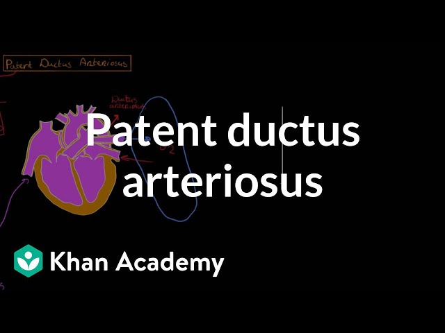 Patent ductus arteriosus | Circulatory System and Disease | NCLEX-RN | Khan Academy