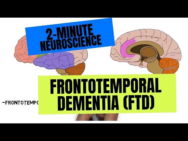 2-Minute Neuroscience: Frontotemporal Dementia (FTD)