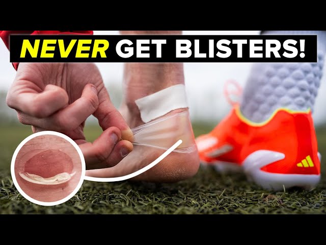 How to NEVER get blisters again from your football boots!