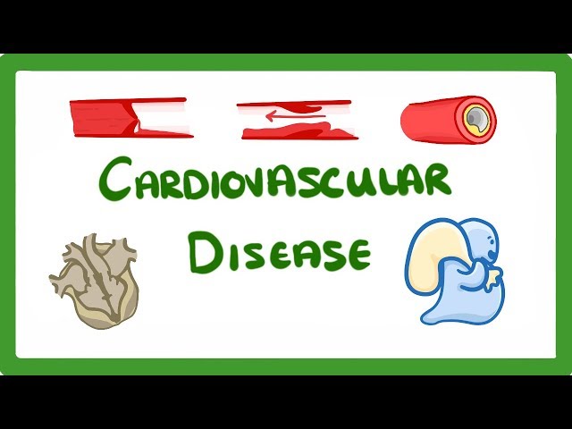 GCSE Biology - Why Do We Get Heart Disease and How to Treat It? - Cardiovascular Disease (CVD)  #47