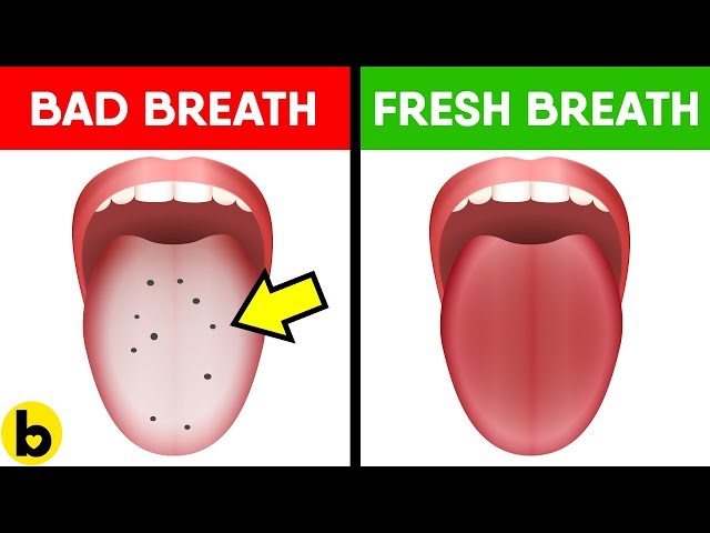 Get Rid Of BAD BREATH Fast With These 12 Proven Home Remedies
